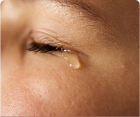 Obstrução Lacrimal em crianças